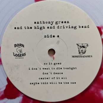 LP Anthony Green: Boom. Done.