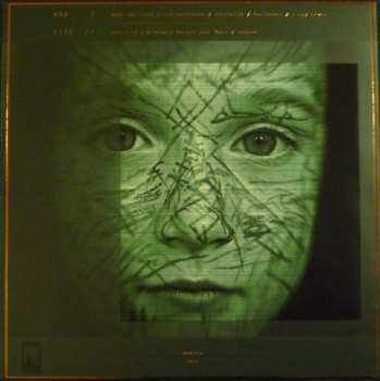 LP/CD Apoptose: Ana Liil