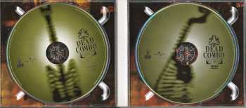 CD/DVD Dead Combo: Lusitânia Playboys