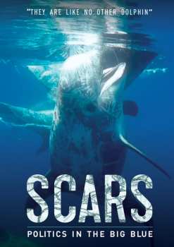 DVD Feature Film: Scars
