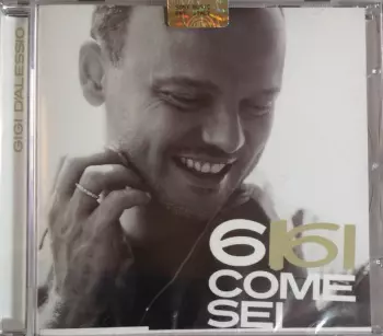 Gigi D'Alessio: 6 Come Sei