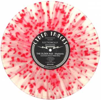 LP Implants: The Olden Age LTD | CLR