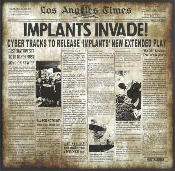 LP Implants: The Olden Age LTD | CLR