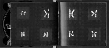 CD Lightwave: Caryotype