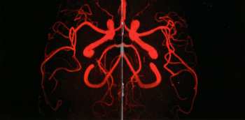 CD Peter Gabriel: Scratch My Back